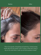 Hinu- Hair Growth Oil 60ml